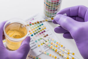 infecção urinária: é preciso tratar!