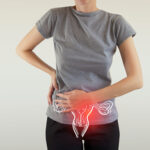 endometriose, tem tratamento! Pare de sofrer.